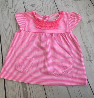 12 Months Striped  Tunic Top